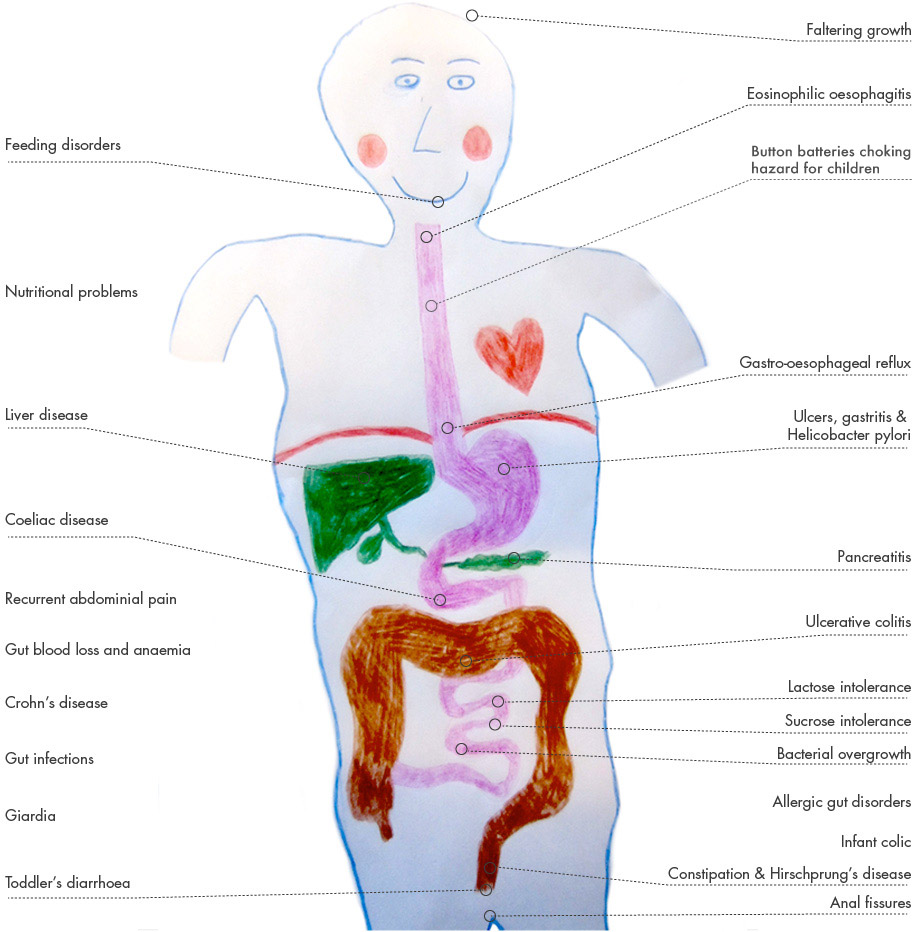 Gut investigations model